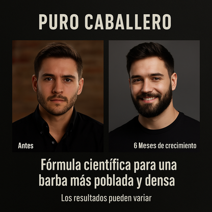 Aceite para Crecimiento de Barba con Minoxidil: Minoxidil para Hombres