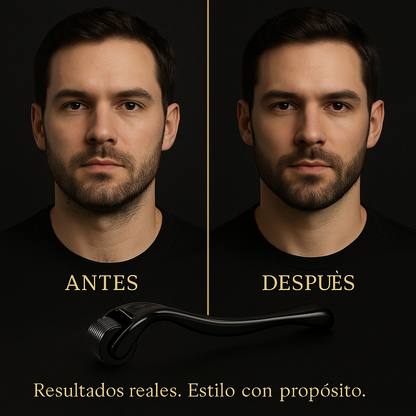 Derma Roller